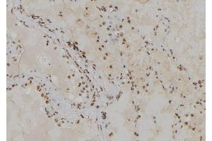 ABIN6279359 at 1/100 staining Human lung tissue by IHC-P. (POLA2 抗体  (Internal Region))