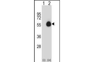 Western blot analysis of CD33 (arrow) using rabbit polyclonal CD33 Antibody (Center) (ABIN657464 and ABIN2846492). (CD33 抗体  (AA 88-117))