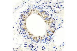 Immunohistochemistry of paraffin-embedded mouse lung using ENDOG antibody (ABIN5997672) at dilution of 1/100 (40x lens). (Endonuclease G 抗体)