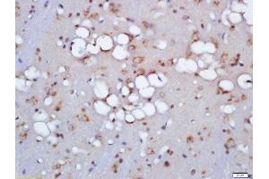 Formalin-fixed and paraffin embedded rat brain labeled with Anti-ZNRF3 Polyclonal Antibody, Unconjugated  at 1:200 followed by conjugation to the secondary antibody and DAB staining (ZNRF3 抗体  (AA 120-165))