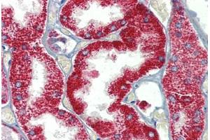 Kidney, Human: Formalin-Fixed, Paraffin-Embedded (FFPE) (SH3BP2 抗体  (AA 432-481))