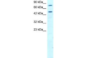 WB Suggested Anti-RGS9 Antibody Titration:  2. (RGS 抗体  (N-Term))