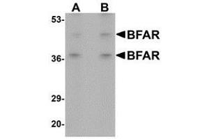 Western blot analysis of BFAR in human kidney tissue lysate with AP30141PU-N BFAR antibody at (A) 1 and (B) 2 μg/ml. (BFAR 抗体  (C-Term))