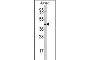 Western blot analysis of PTPN7 polyclonal antibody  in Jurkat cell line lysates (35 ug/lane). (PTPN7 抗体  (Ser44))