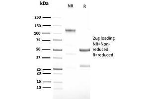 SDS-PAGE Analysis Purified G-CSF Recombinant Rabbit Monoclonal Antibody (CSF3/3166R). (Recombinant G-CSF 抗体)