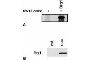 Western Blotting (WB) image for anti-SWI/SNF Related, Matrix Associated, Actin Dependent Regulator of Chromatin, Subfamily A, Member 4 (SMARCA4) (C-Term) antibody (ABIN614772) (SMARCA4 抗体  (C-Term))