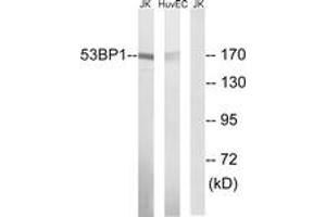 Western blot analysis of extracts from Jurkat/HuvEc cells, using 53BP1 (Ab-29) Antibody. (TP53BP1 抗体  (AA 14-63))