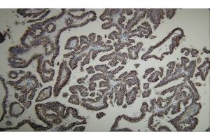 Immunohistochemistry (IHC) image for anti-alpha-Methylacyl-CoA Racemase (AMACR) (AA 367-381), (C-Term) antibody (ABIN7598866) (AMACR 抗体  (C-Term))