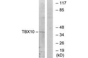 Western Blotting (WB) image for anti-T-Box 10 (TBX10) (AA 261-310) antibody (ABIN2889341) (T-Box 10 抗体  (AA 261-310))