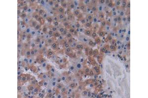 Used in DAB staining on fromalin fixed paraffin- embedded Kidney tissue (LAMB2 抗体  (AA 939-1129))