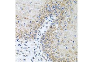 Immunohistochemistry of paraffin-embedded human esophagus using CPM antibody (ABIN6128978, ABIN6138956, ABIN6138957 and ABIN6222238) at dilution of 1:100 (40x lens). (CPM 抗体  (AA 204-443))