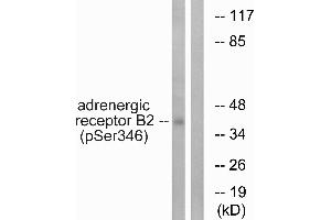 Immunohistochemistry analysis of paraffin-embedded human brain tissue using Adrenergic Receptor β2 (Phospho-Ser346) antibody. (beta 2 Adrenergic Receptor 抗体  (pSer346))