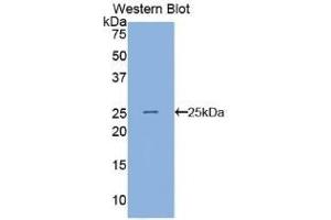 Detection of Recombinant ANGPTL8, Human using Polyclonal Antibody to Angiopoietin Like Protein 8 (ANGPTL8) (C19ORF80 抗体  (AA 24-196))