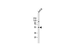 Anti-NETO2 Antibody (N-term ) at 1:2000 dilution + Jurkat whole cell lysate Lysates/proteins at 20 μg per lane.
