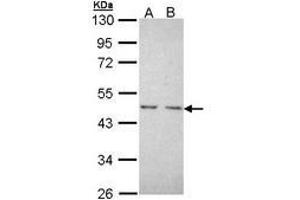 Image no. 1 for anti-Nuclear Receptor Subfamily 2, Group C, Member 1 (NR2C1) (AA 1-220) antibody (ABIN467508) (NR2C1 抗体  (AA 1-220))