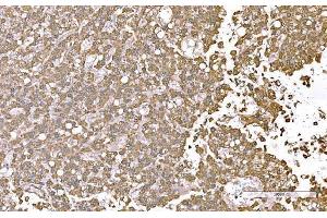 IHC analysis of SND1 using anti-SND1 antibody (ABIN7600525). (SND1 抗体  (AA 20-204))