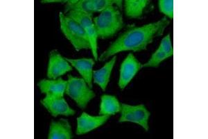 Immunofluorescenitrocellulosee of human HeLa cells stained with Hoechst 33342 (Blue) and monoclonal anti-Hexokinase antibody (1:1000) with Alexa 488 (Green). (Hexokinase 抗体  (AA 1-917))