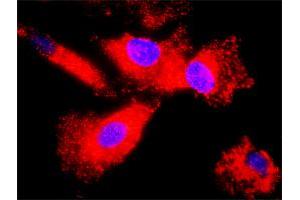 Proximity Ligation Analysis of protein-protein interactions between HSPB1 and EGFR.