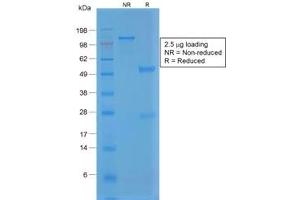 SDS-PAGE analysis of purified, BSA-free recombinant vWF antibody (clone VWF/1859R) as confirmation of integrity and purity. (Recombinant VWF 抗体  (AA 1815-1939))