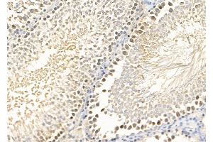 ABIN7094438 and ABIN7098486 at 1/100 staining Rat testis tissue by IHC-P. (FOXG1 抗体  (C-Term))