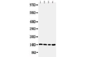 Anti-Stefin B antibody, Western blotting Lane 1: A549 Cell Lysate Lane 2: A431 Cell Lysate Lane 3: COLO320 Cell Lysate Lane 4: HELA Cell Lysate (CSTB 抗体  (Middle Region))