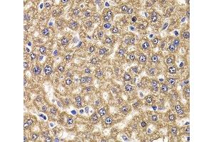 Immunohistochemistry of paraffin-embedded Rat liver using UBE2J2 Polyclonal Antibody at dilution of 1:100 (40x lens). (UBE2J2 抗体)