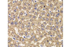 Immunohistochemistry of paraffin-embedded Rat liver using UBE2J2 Polyclonal Antibody at dilution of 1:100 (40x lens). (UBE2J2 抗体)