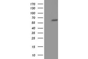Western Blotting (WB) image for anti-Kelch-Like 2, Mayven (KLHL2) (AA 1-100), (AA 494-593) antibody (ABIN1490550) (KLHL2 抗体  (AA 1-100, AA 494-593))