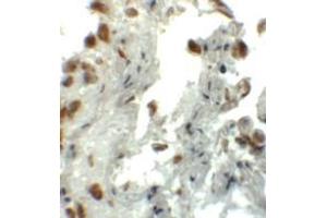 Immunohistochemistry (IHC) image for anti-Enhancer of Zeste Homolog 1 (EZH1) (N-Term) antibody (ABIN1031377) (EZH1 抗体  (N-Term))