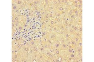 Immunohistochemistry of paraffin-embedded human liver tissue using ABIN7145396 at dilution of 1:100 (B4GALT5 抗体  (AA 101-388))