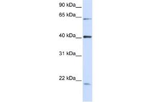 WB Suggested Anti-C19orf46 Antibody Titration:  0. (C19orf46 抗体  (N-Term))