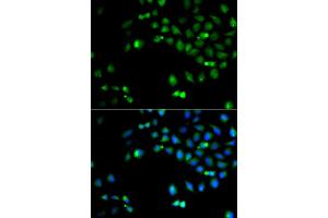 Immunofluorescence analysis of A549 cell using HOXA1 antibody. (HOXA1 抗体)