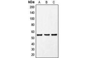 Western blot analysis of FRK expression in K562 (A), Molt4 (B), PC12 (C) whole cell lysates. (FRK 抗体  (Center))