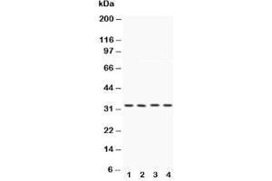 Western blot testing of Caspase-7 antibody and Lane 1:  HeLa;  2: MCF-7;  3: rat liver;  4: rat kidney (Caspase 7 抗体  (AA 237-255))
