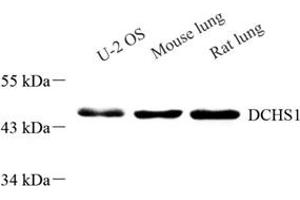 Western blot analysis of DCHS1 (ABIN7073689),at dilution of 1: 800 (DCHS1 抗体)