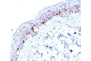 IHC testing of human human skin stained with CD1a antibody (O10). (CD1a 抗体)