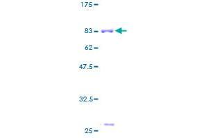 ASL Protein (AA 1-464) (GST tag)