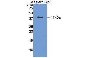 Western Blotting (WB) image for anti-Tryptase alpha/beta 1 (TPSAB1) (AA 161-262) antibody (ABIN1174171) (TPSAB1 抗体  (AA 161-262))