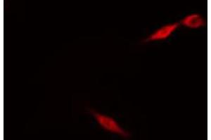 ABIN6274214 staining HeLa cells by IF/ICC. (MARK3 抗体  (N-Term))