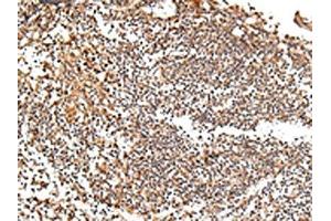 The image on the left is immunohistochemistry of paraffin-embedded Human tonsil tissue using ABIN7193077(XKR7 Antibody) at dilution 1/20, on the right is treated with synthetic peptide. (XKR7 抗体)