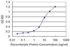 Detection limit for recombinant GST tagged GOT2 is 0. (GOT2 抗体  (AA 331-430))