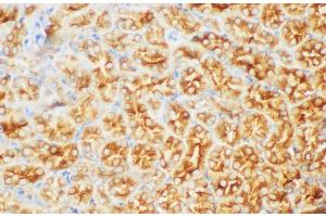 Immunohistochemistry of paraffin-embedded Mouse kidney using FGB Polycloanl Antibody at dilution of 1:200 (Fibrinogen beta Chain 抗体)