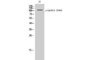 Western Blotting (WB) image for anti-EPHA2/5 (pTyr594) antibody (ABIN3180443) (EPHA2/5 (pTyr594) 抗体)