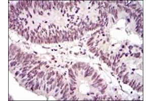Immunohistochemistry (IHC) image for anti-NCK Adaptor Protein 1 (NCK1) antibody (ABIN1108388) (NCK1 抗体)