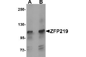 Western blot analysis of ZFP219 in mouse brain tissue lysate with ZFP219 antibody at (A) 1 and (B) 2 µg/mL. (ZNF219 抗体  (N-Term))