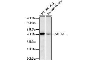 Western blot analysis of extracts of various cell lines, using (ABIN6131630, ABIN6147868, ABIN6147869 and ABIN6219899) at 1:1000 dilution. (SLC1A1 抗体  (AA 430-524))