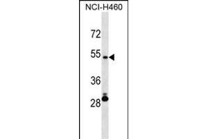 IRX6 Antibody (Center) (ABIN1538203 and ABIN2850242) western blot analysis in NCI- cell line lysates (35 μg/lane). (IRX6 抗体  (AA 260-288))