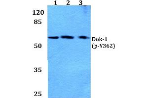Western blot (WB) analysis of p-Dok-1 antibody at 1/500 dilution (DOK1 抗体  (pTyr362))