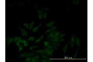 Immunofluorescence of monoclonal antibody to SERPINB5 on HeLa cell. (SERPINB5 抗体  (AA 1-231))