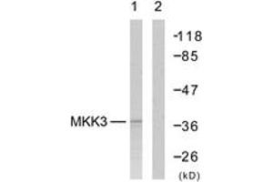Western blot analysis of extracts from MDA-MB-435 cells, using MKK6 (Ab-207) Antibody. (MAP2K6 抗体  (AA 173-222))